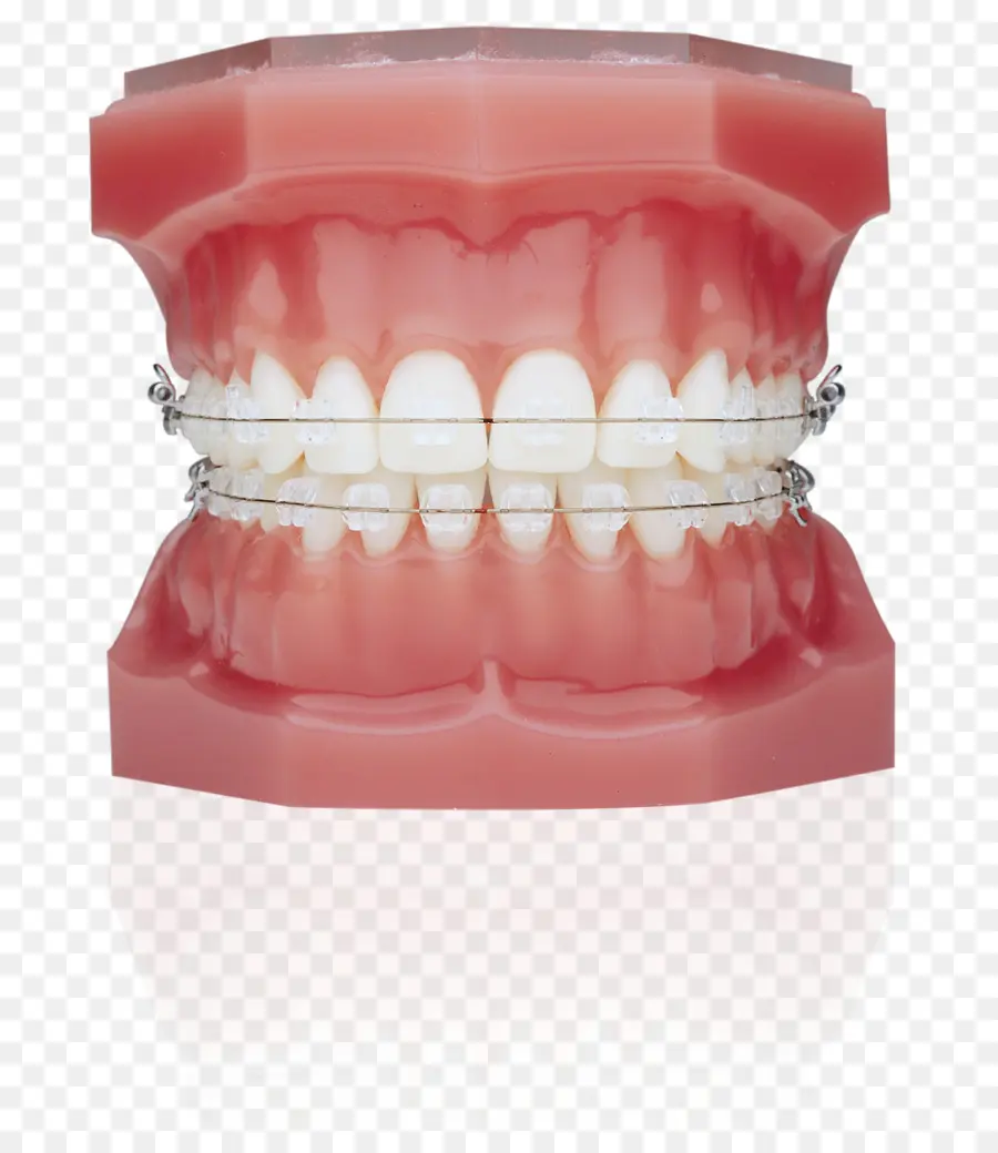 Diş Teli，Ortodonti PNG