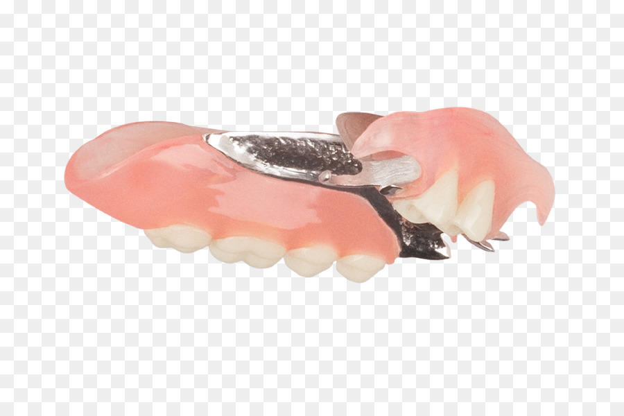 Çıkarılabilir Kısmi Protez，Takma Dişler PNG
