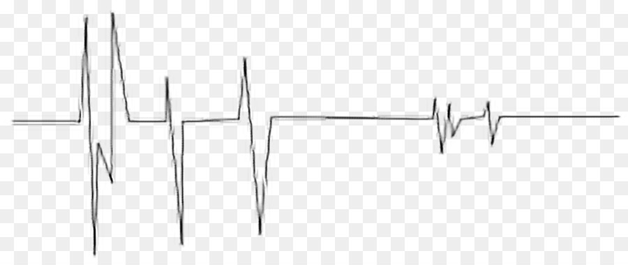 Kalp Atışı Hattı，Ekg PNG