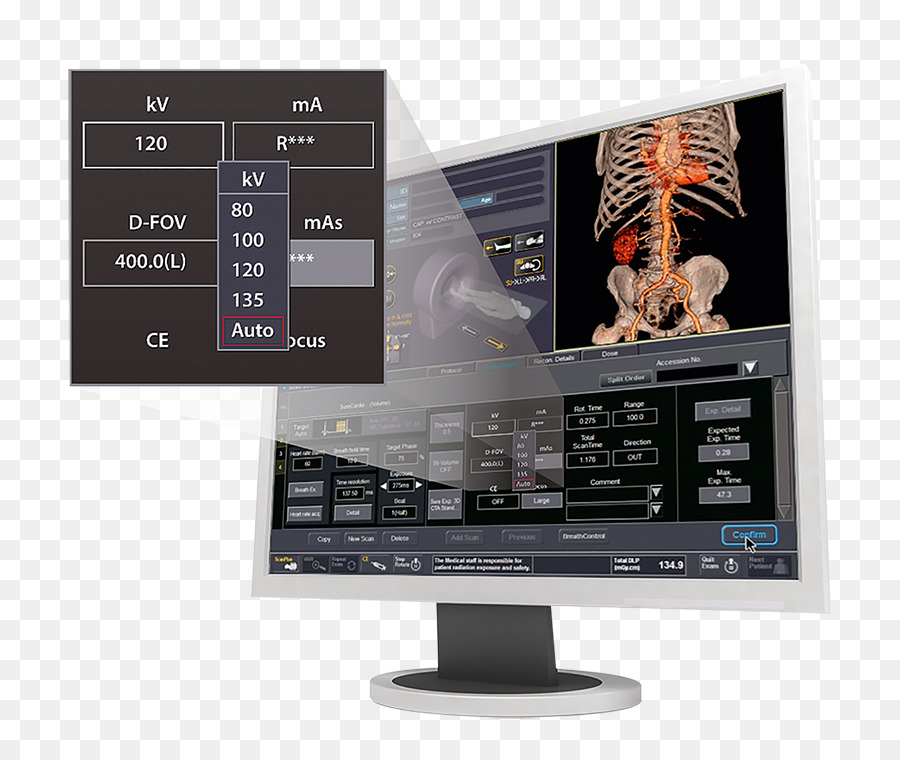 Bilgisayar Monitörleri，Canon Medical Systems Corporation PNG