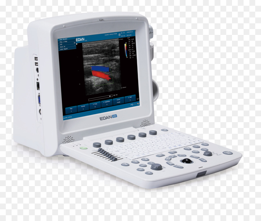Ultrasonografi，Ultrason PNG