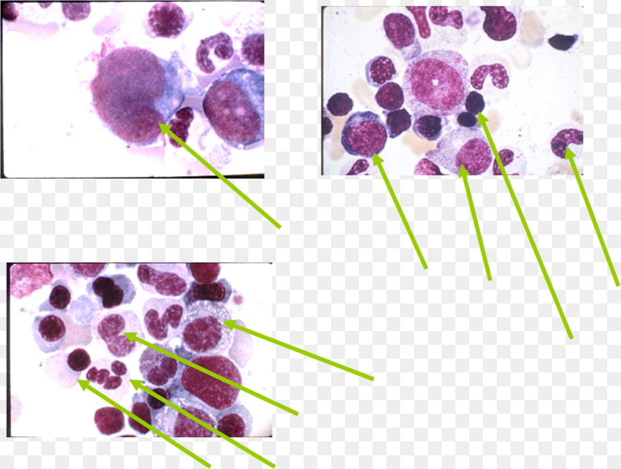 çiçekli Bitki，Promyelocyte PNG