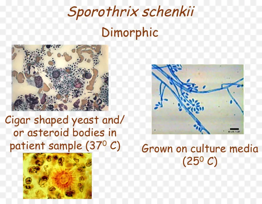 Sporothrix Schenckii，Organizma PNG