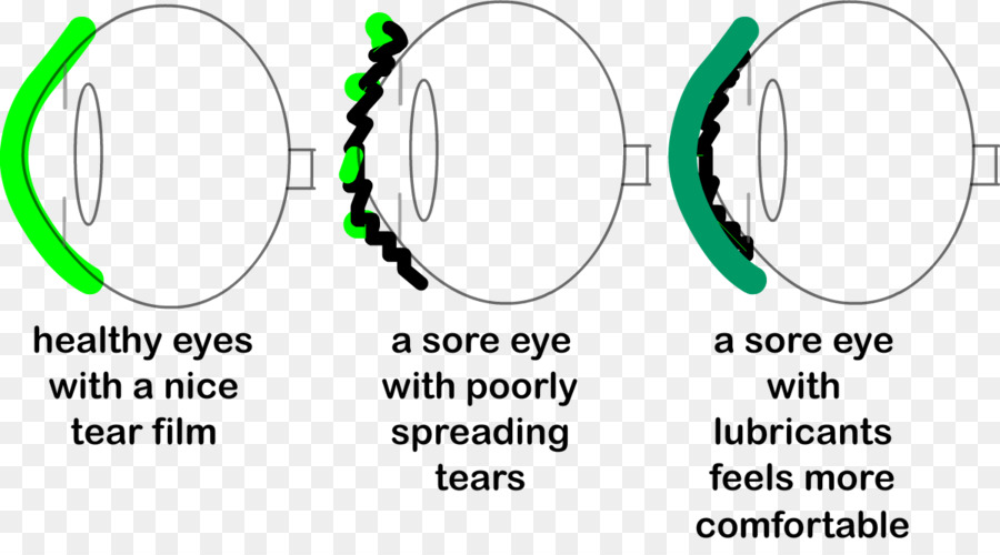Göz Diyagramı，Göz Yaşları PNG