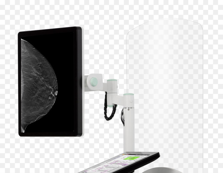 Tıbbi Görüntüleme，Mammografi PNG