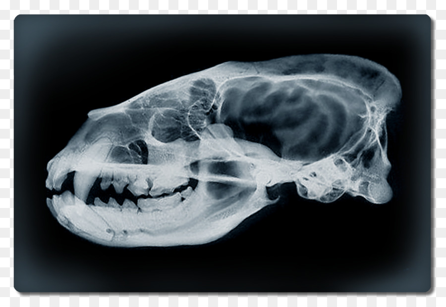 Bilgisayarlı Tomografi，Interparietal Kemik PNG