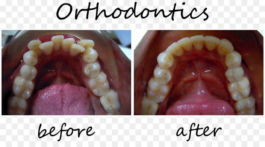 Ortodonti，Dişçilik PNG