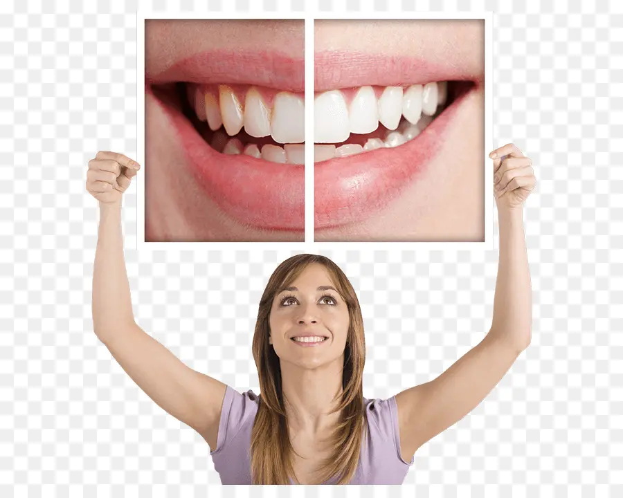 Diş Beyazlatma，Diş Hekimi PNG