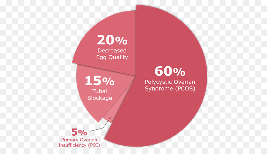 Yetersizlik Hamile Kalmak，Polikistik Over Sendromu Kısırlık PNG